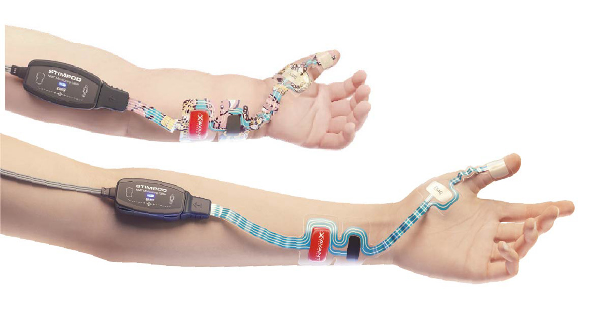 EMG electrode applied along the arm to the hand